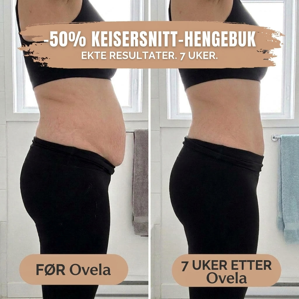 Postpartum-truse — 360° kompresjon