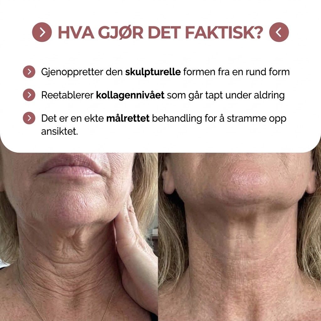 kompresjonsenhet med frigjøring av 300 dalton kollagen